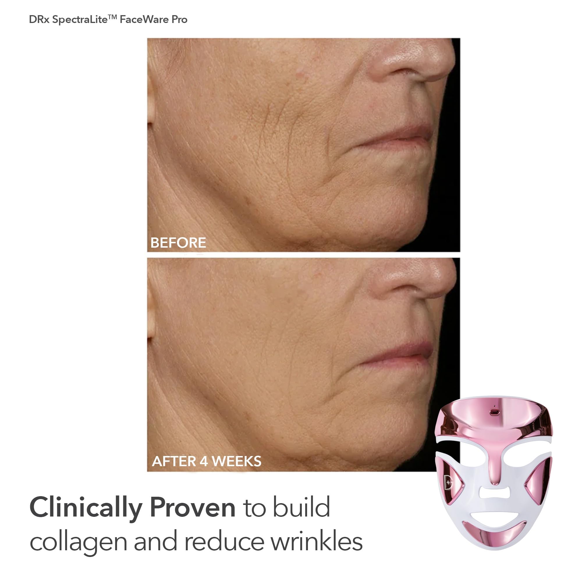 Dr. Dennis Gross DRx SpectraLite FaceWare Pro – LED Face Mask for Skin Rejuvenation with Dual Red & Blue Light Therapy, FSA HSA Eligible: Pink + Brighten Firm Kit