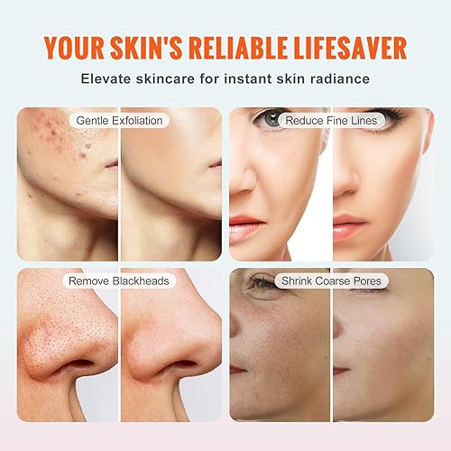Miniatura 6 de VEVOR Máquina de microdermoabrasión de diamante, máquina de dermoabrasión profesional 3 en 1 con succión máxima de 70 cmHg, 9 puntas de diamante, 2