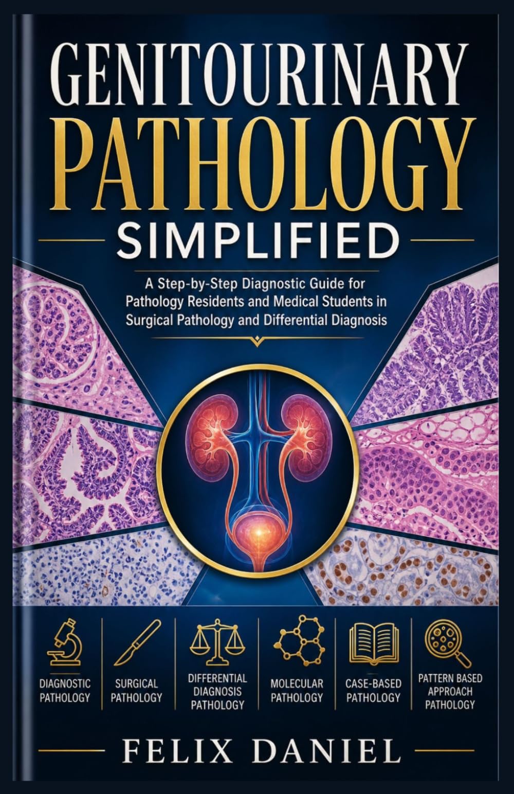 Genitourinary Pathology Simplified: A Step-by-Step Diagnostic Guide for Pathology Residents and Medical Students in Surgical Pathology and Differential Diagnosis