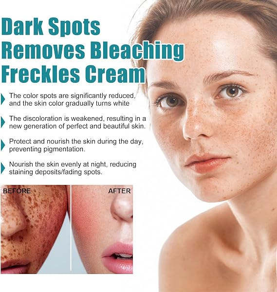 Dark Spot Remover for Face and Body,Dark Spot Corrector Freckle Remover,Pigmentation Removal Cream,Melasma Removal Cream for Face,Containing Niacinamide and Glycerol,Brightening,20ML