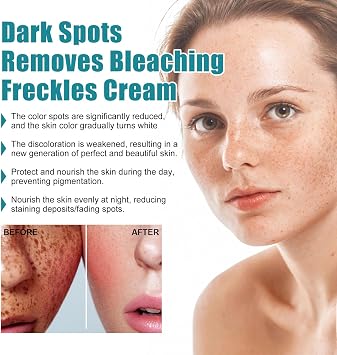 Dark Spot Remover for Face and Body,Dark Spot Corrector Freckle Remover,Pigmentation Removal Cream,Melasma Removal Cream for Face,Containing Niacinamide and Glycerol,Brightening,20ML