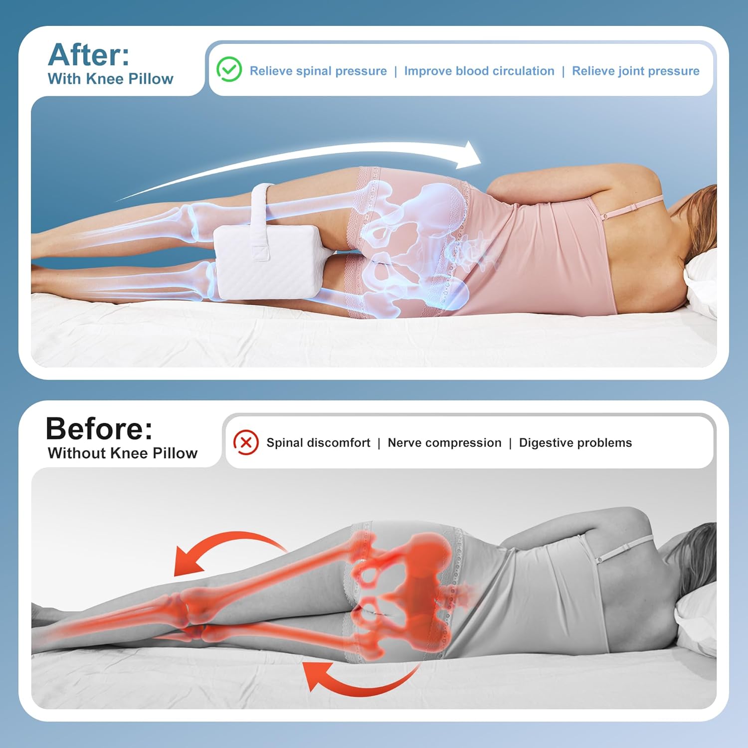 Knee Pillow for Side Sleepers, Leg Pillow for Sciatica, Back, HIPS, Knees, Joints Pain Relief,Pillows for Between Legs While Sleeping Spine Alignment Support & Relieves Pressure,Basic Strap,White - Image 5