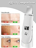 Vista 6 de Espátula facial 4 en 1 para limpiar los poros, espátula facial para limpieza facial profunda con cargador USB