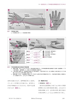 MEDICAL TECHNOLOGY(メディカルテクノロジー)自信をもって神経
