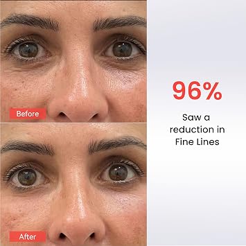 AMIRO Red Light Therapy for Eyes, 4 Wavelengths Led Eye Mask for Fine Lines