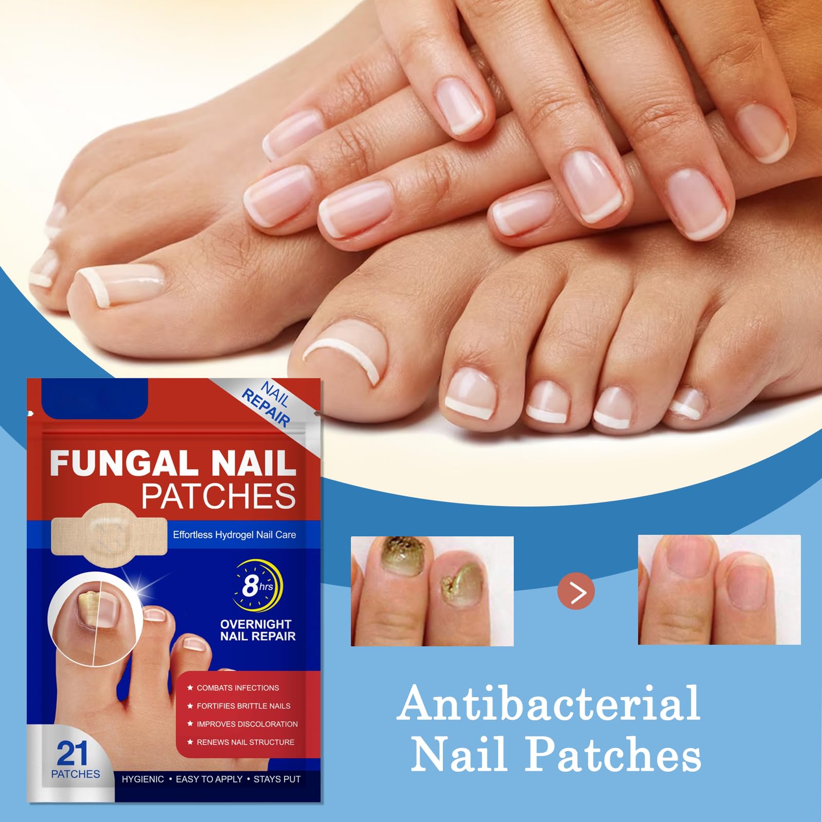 Fungal Nail Hydrogel Patches for Toenail Overnight - Image 2