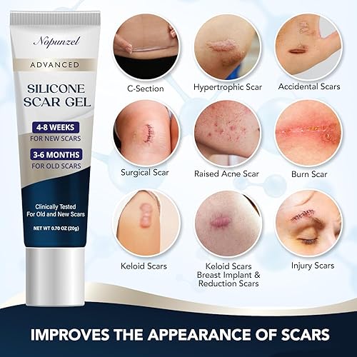 Miniatura 2 de Gel de silicona para cicatrices, gel de silicona para cicatrices, mejora la apariencia de cicatrices viejas y nuevas, silicona de grado médico, gel