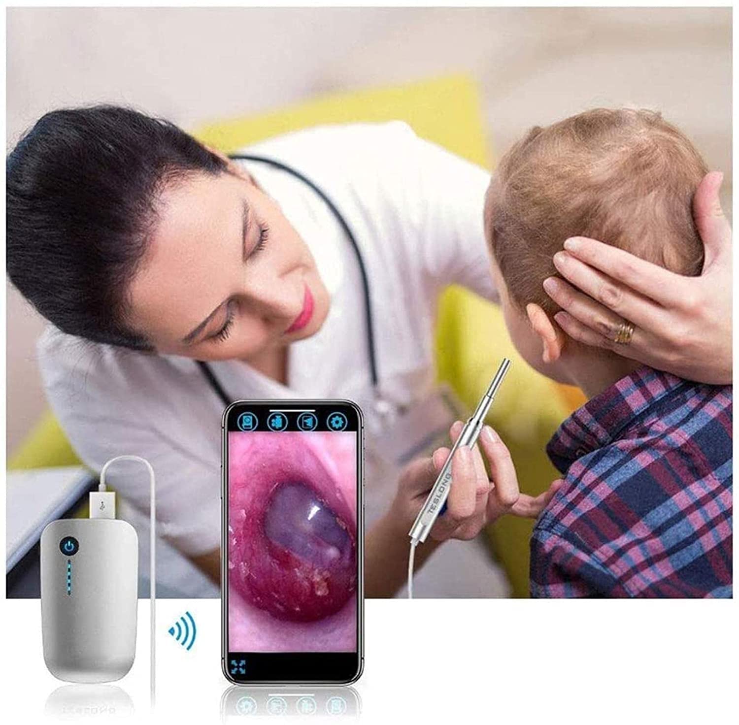 Herramienta de eliminación de Cera de Oreja, 10 0w HD Limpiador de Orejas Oído inalámbrico Otascopio con 6 DIRIGIÓ Luz, ámbito Impermeable for la Oreja con Herramienta removedor de Earwax