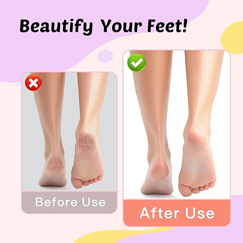 Miniatura 5 de Removedor eléctrico de callos de pies y lima de uñas, removedor eléctrico de callos para pies, 9 velocidades ajustables, 1800 mAh recargable, cuerpo