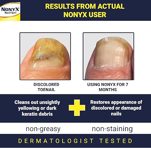 Miniatura 2 de Gel para uñas Nonyx 4 onzas nail gel paquete de de 1 Transparente 1 1