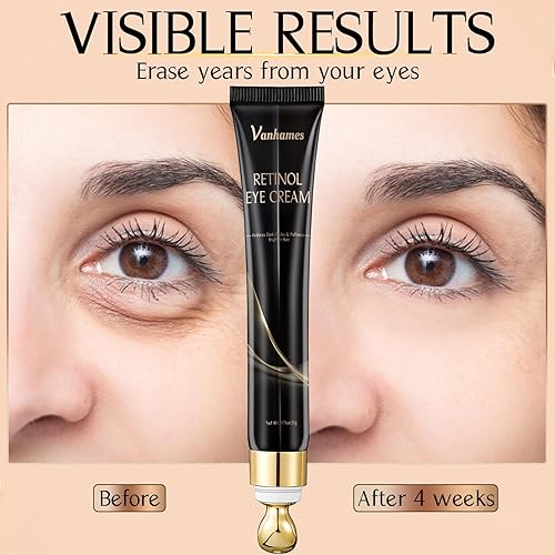 Miniatura 3 de Crema de ojos con cafeína con retinol, crema para debajo de los ojos para ojeras e hinchazón, crema antienvejecimiento para ojos, tratamiento de