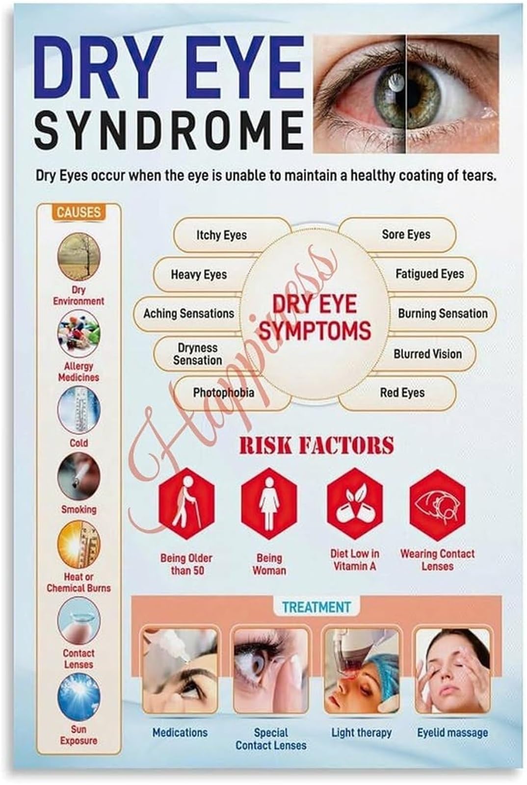 MQXFCZUX Dry Eye Syndrome Poster Causes Symptoms Risk Factors Treatments Wall-Art Unframed,16x24inch(40x60cm)