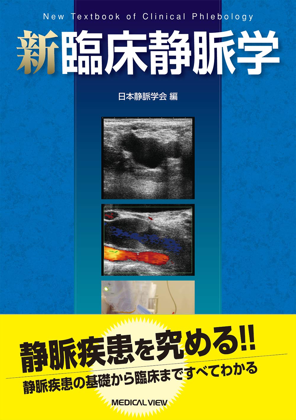 新臨床静脈学 | 日本静脈学会 |本 | 通販 | Amazon
