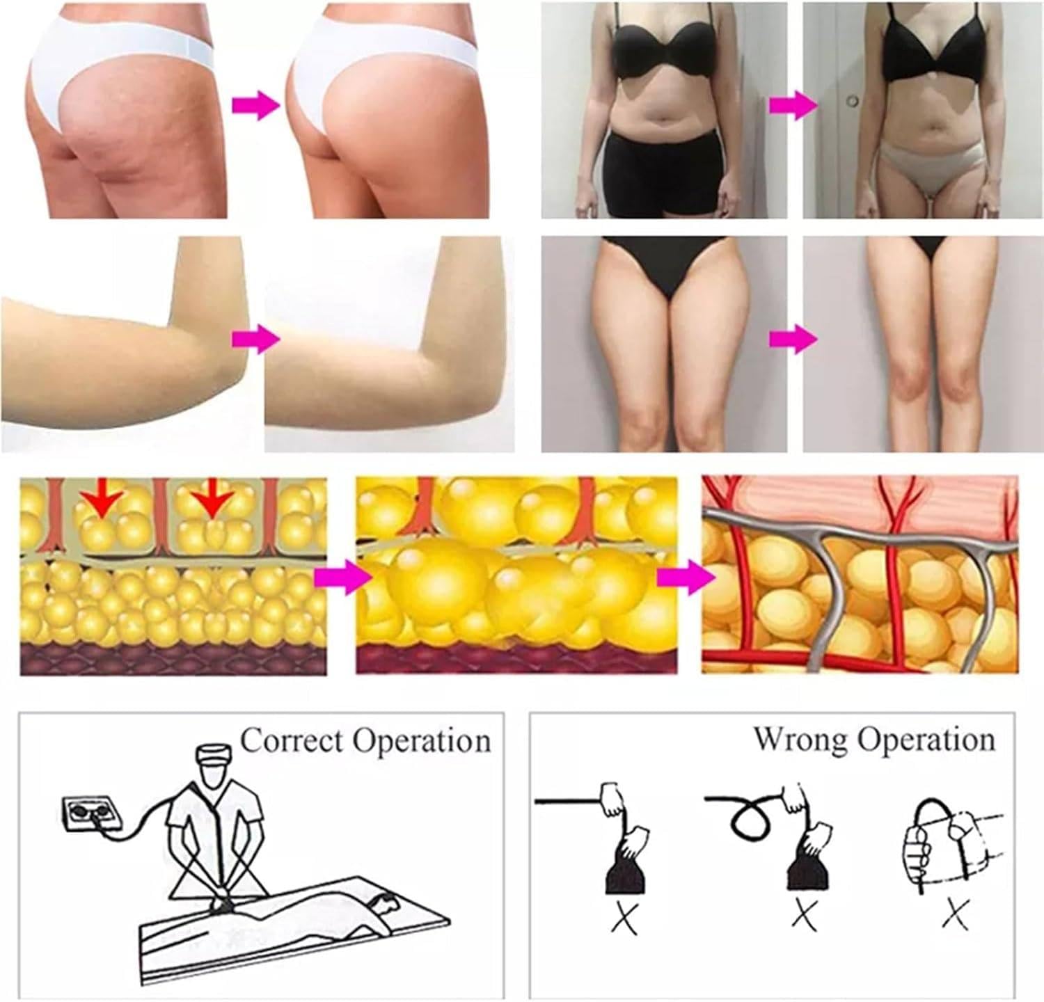 High Frequency G8 Max Elektryczny Full Body Shaper, Elektryczny Wibrujący Masażer Wyszczuplający Do Ciała, 9 ​​W 1 Maszyna Do Pielęgnacji Ciała, Z 9 Głowicą Masażującą
