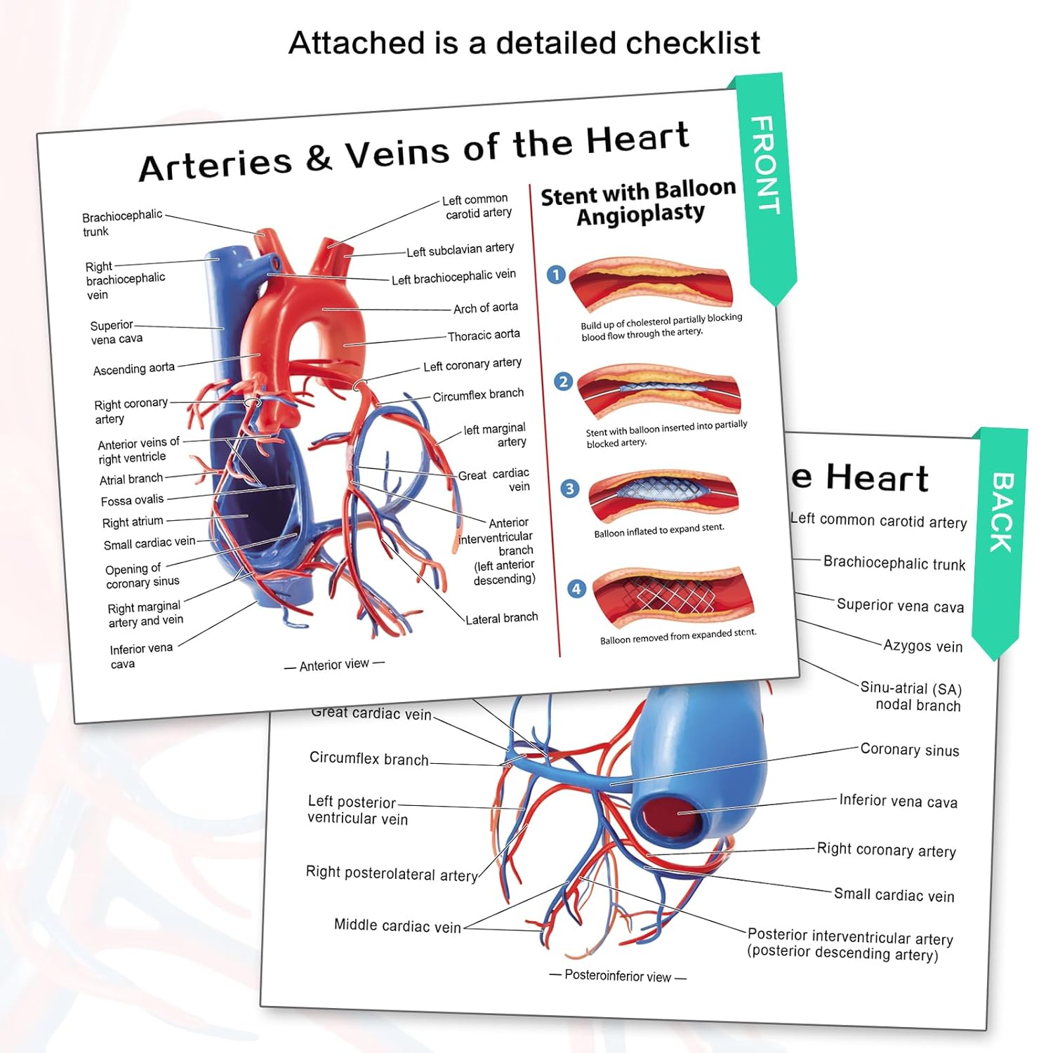 Human Heart Vascular Model, Life Size Cardiovascular Model Showing The Arteries and Veins with Base for Medical Classroom and Cardiology Study