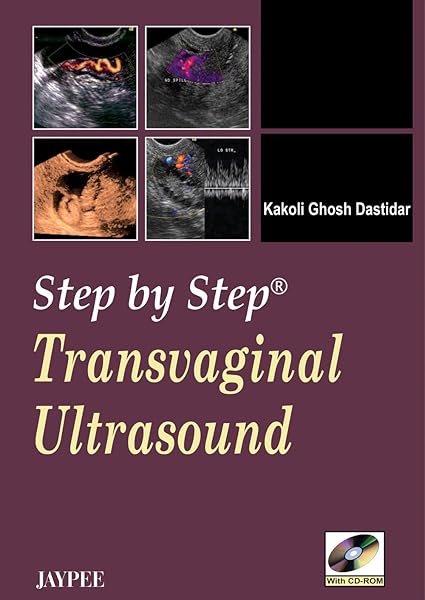 Step By Step Transvaginal Ultrasound with CD-ROM