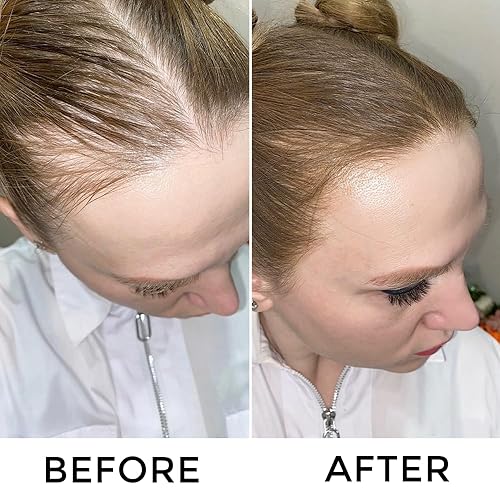 Miniatura 3 de VOLLUCK Polvo para retoque de raíces + sombra de línea capilar con fibras capilares para adelgazar el cabello, rubio claro