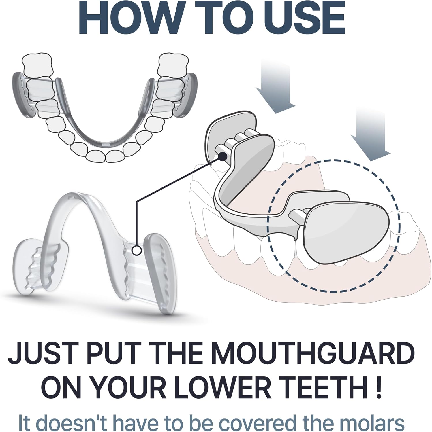 Mouth Guard for Grinding and Clenching Teeth at Night, Sleep Night Guard, Grinding Protection, Clenching Protection, Teeth Bruxism Mouth Piece with Travel Hygiene Case (2set) (1set) - Image 7