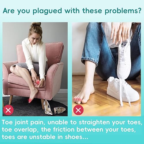 Miniatura 2 de Corrector de dedos de gel en martillo  Alisadores de dedos de martillo para dedos rizados  Separadores de dedos para mujeres y hombres  Levanta la