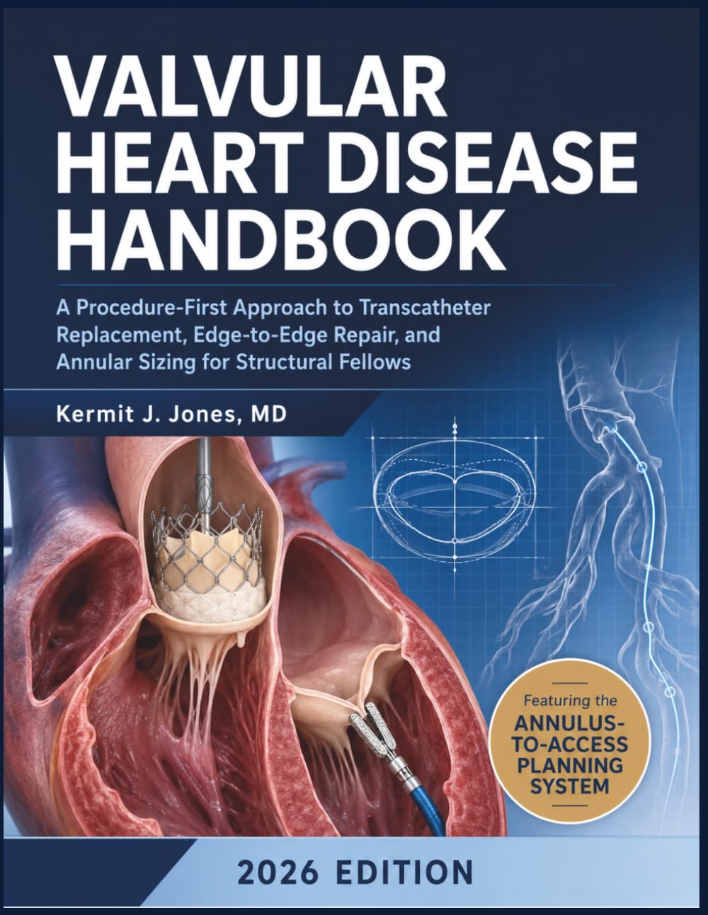 Valvular Heart Disease Handbook: A Procedure-First Approach to Transcatheter Replacement, Edge-to-Edge Repair, and Annular Sizing for Structural Fellows