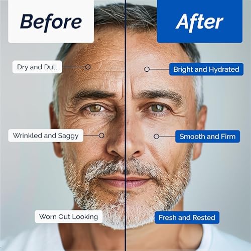 Miniatura 3 de Omnis Uomo Crema facial  Hidratante con retinol y ácido hialurónico, efecto refrescante, reduce arrugas y manchas oscuras, mejora la elasticidad y