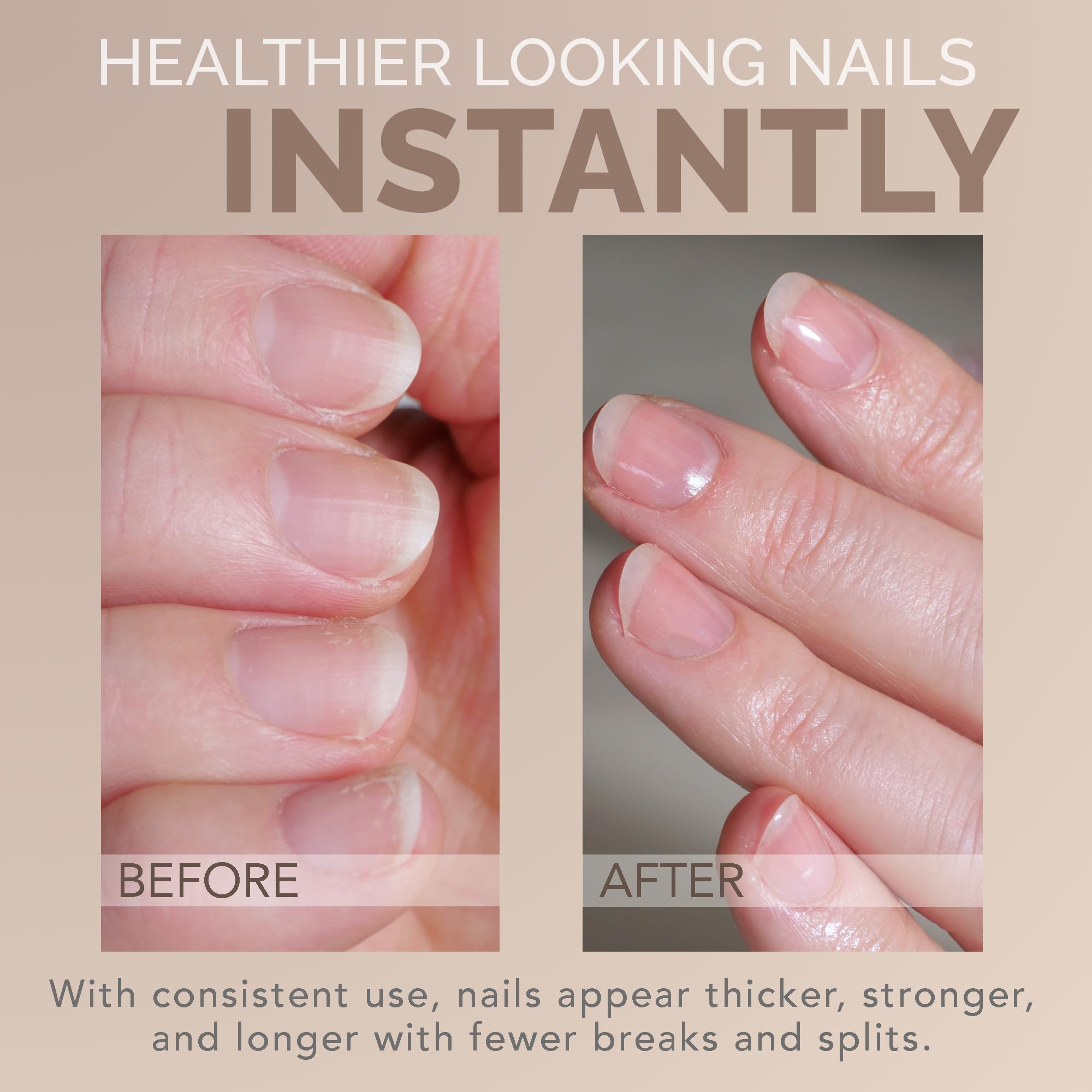 Perfect Formula Gel Coat Nail Strengthener & Keratin Treatment, 0.6 oz