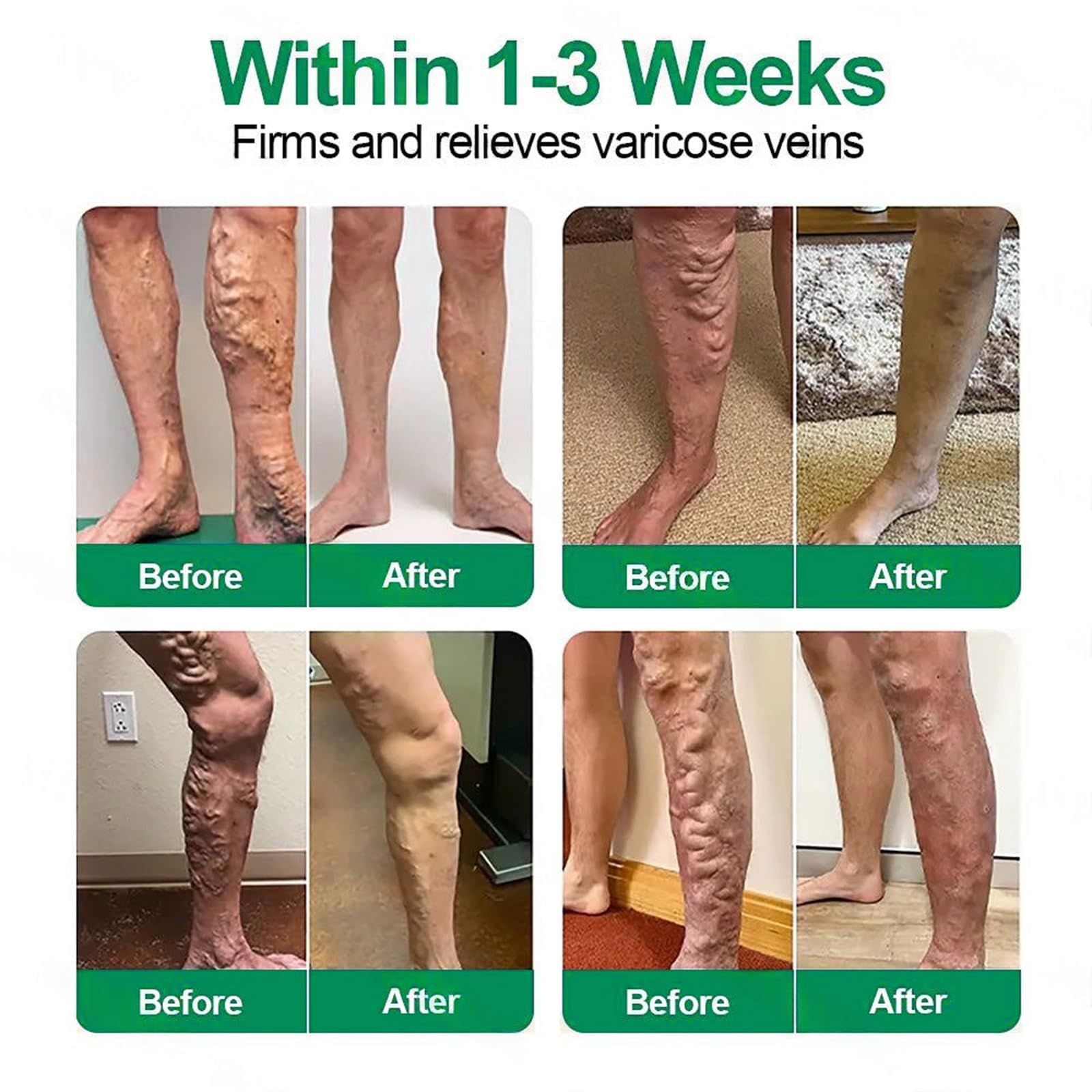 12 Unidades Target parche avanzado con para varices Parche con Microagujas para Venas Varicosas, Tratamiento Natural para Piernas, Apto para Todo Tipo de Piel (8PC+Verde) — view 2