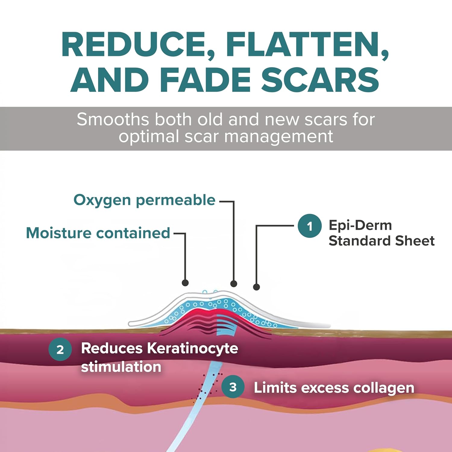 EpiDerm Standard Silicone Scar Sheets – Soft Reusable Premium Silicone Gel Sheets for Tummy Tuck, C-Section, Hysterectomy & Surgical Scars – Flexible Fit & Easy to Clean - 4.7" x 5.7", Natural, 5-Pack