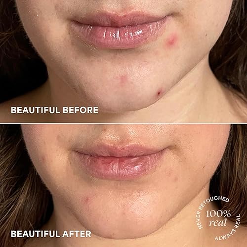 Miniatura 8 de TULA Gotas de tratamiento iluminador para el cuidado de la piel, suero de vitamina C, ilumina el aspecto de la piel opaca y las manchas oscuras, 1