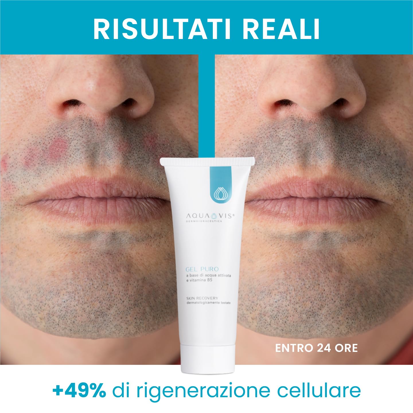 Aquavis® Gel Puro Rigenerante Lenitivo Con Aquavis, Pantenolo, Aloe vera 100% BIO e vitamina B5. (150 ml)