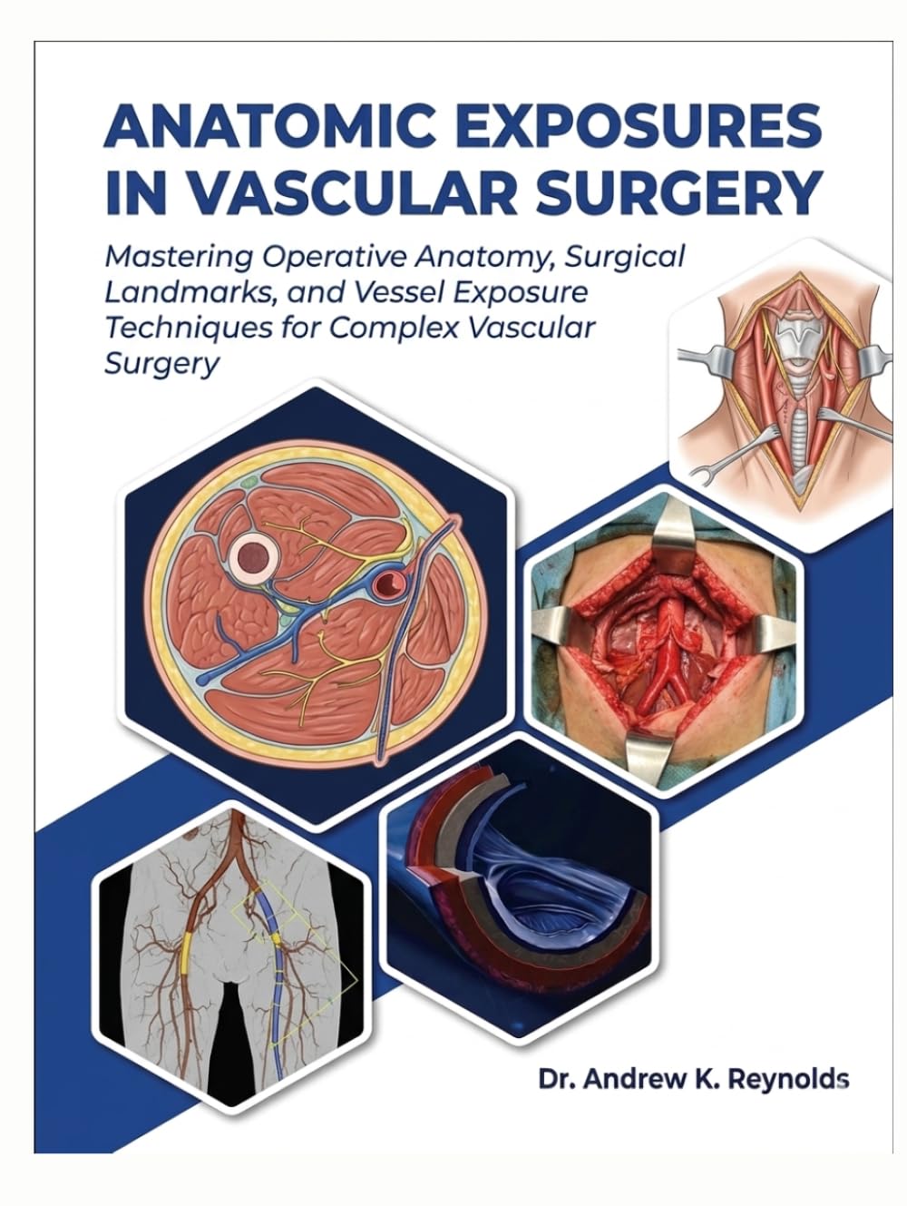ANATOMIC EXPOSURES IN VASCULAR SURGERY: Mastering Operative Anatomy, Surgical Landmarks, and Vessel Exposure Techniques for Complex Vascular Surgery