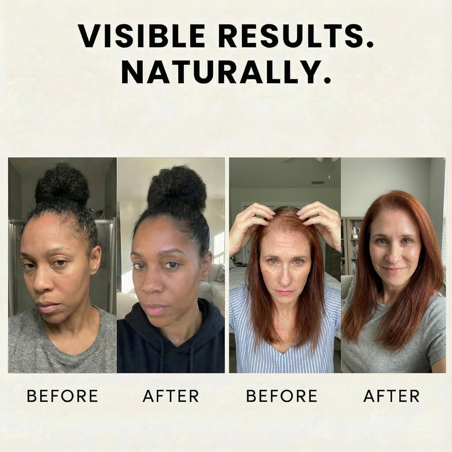 Veganic Natural Hair Growth Oil – Plant Based Vegan Serum, 11 Cold-Pressed Oils with Rosemary & Castor, Scalp Treatment for Dry, Damaged Hair & Split Ends, Helps Reduce Breakage & Shedding (2 Oz)