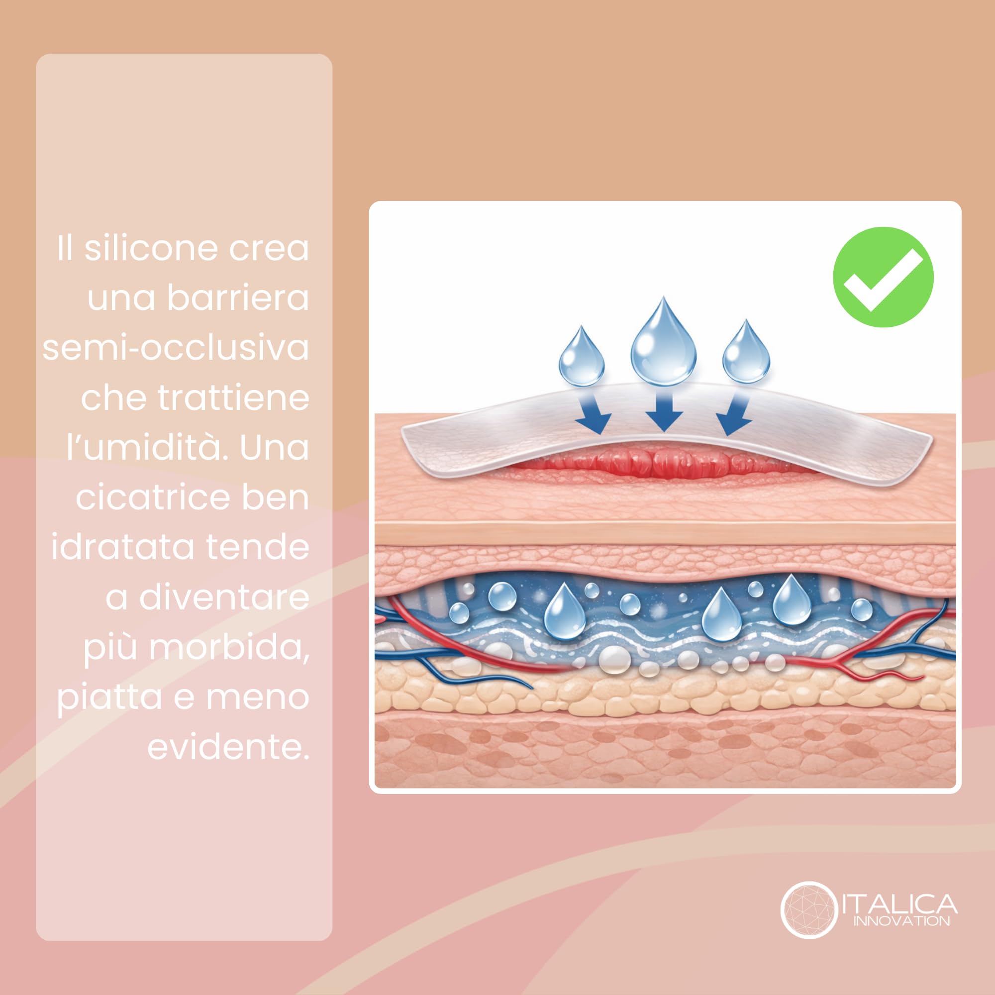 Cerotti in Silicone per Cicatrici, 4x300cm, Ipoallergenici e Riutilizzabili, Impermeabili Post Operatorio, per Cicatrici Chirurgiche, Cesareo, Acne e Cheloidi