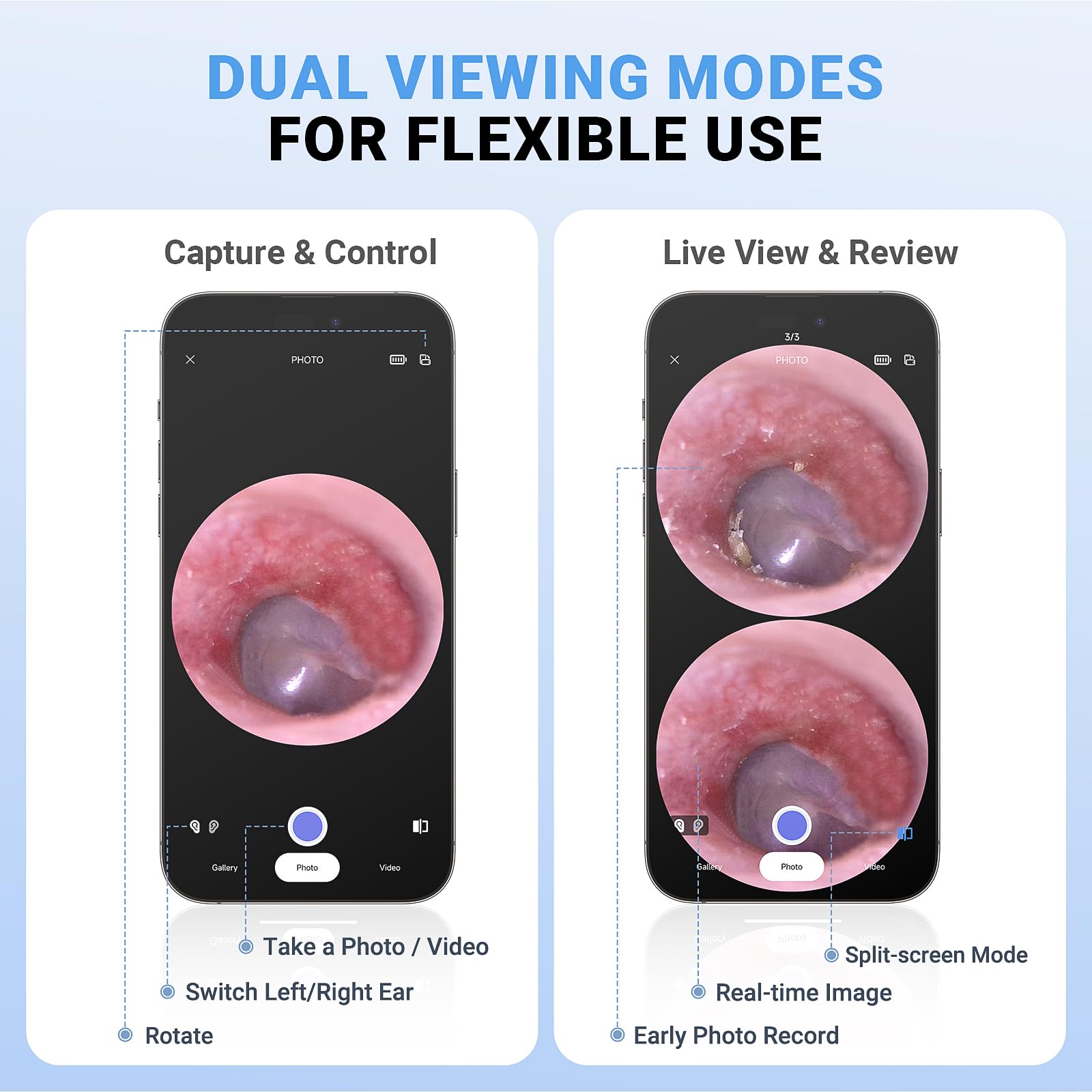 ScopeAround Otoscopio, juego de alcance auditivo 720PHD, otoscopio digital con pantalla IPS de 1.85 pulgadas, cámara de herramienta de eliminación de cera de oído, cámara de video otoscopio con 6