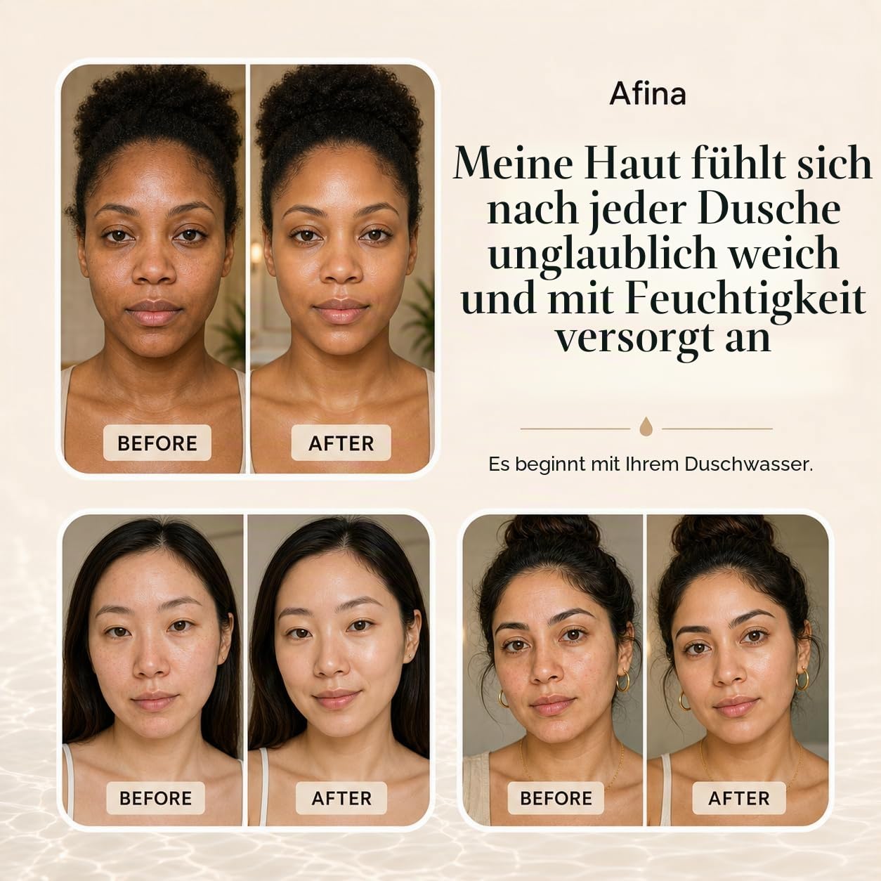Afina A-01 Advanced High Pressure Filtered Shower Head - Reduces Dry Juchy Skin, Dandruff, Ekzeme and Dramatically Improves The Condition of Your Skin, Hair and Nails (Nickel) | KDF-55 Duschfilter & Wasserfilter Duschkopf für hartes Wasser, reduziert Chlo