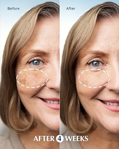 Miniatura 4 de EnaSkin Varita eliminadora de manchas oscuras para la cara suero corrector de manchas oscuras Eliminador de manchas de la edad de las manchas del