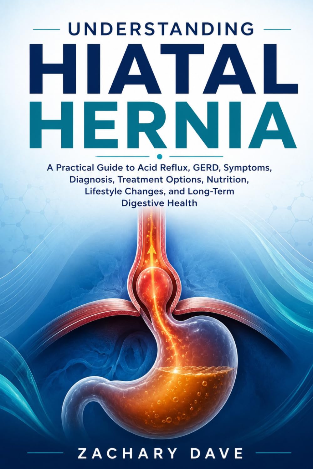 Understanding Hiatal Hernia: A Practical Guide to Acid Reflux, GERD, Symptoms, Diagnosis, Treatment Options, Nutrition, Lifestyle Changes, and Long-Term Digestive Health