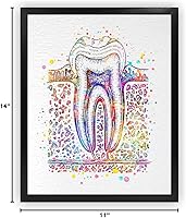 Vista 9 de Dignovel Studios Diagrama de sección transversal de diente humano sin marco de 11 x 14 pulgadas, imagen de diagrama de impresión artística