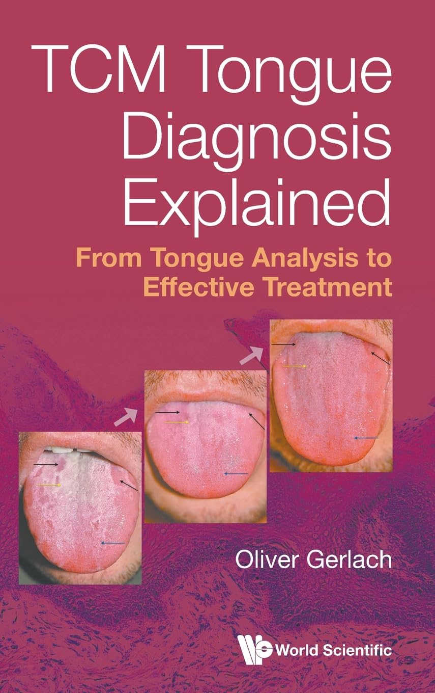 Tcm Tongue Diagnosis Explained: From Tongue Analysis To Effec... - 9789811297359