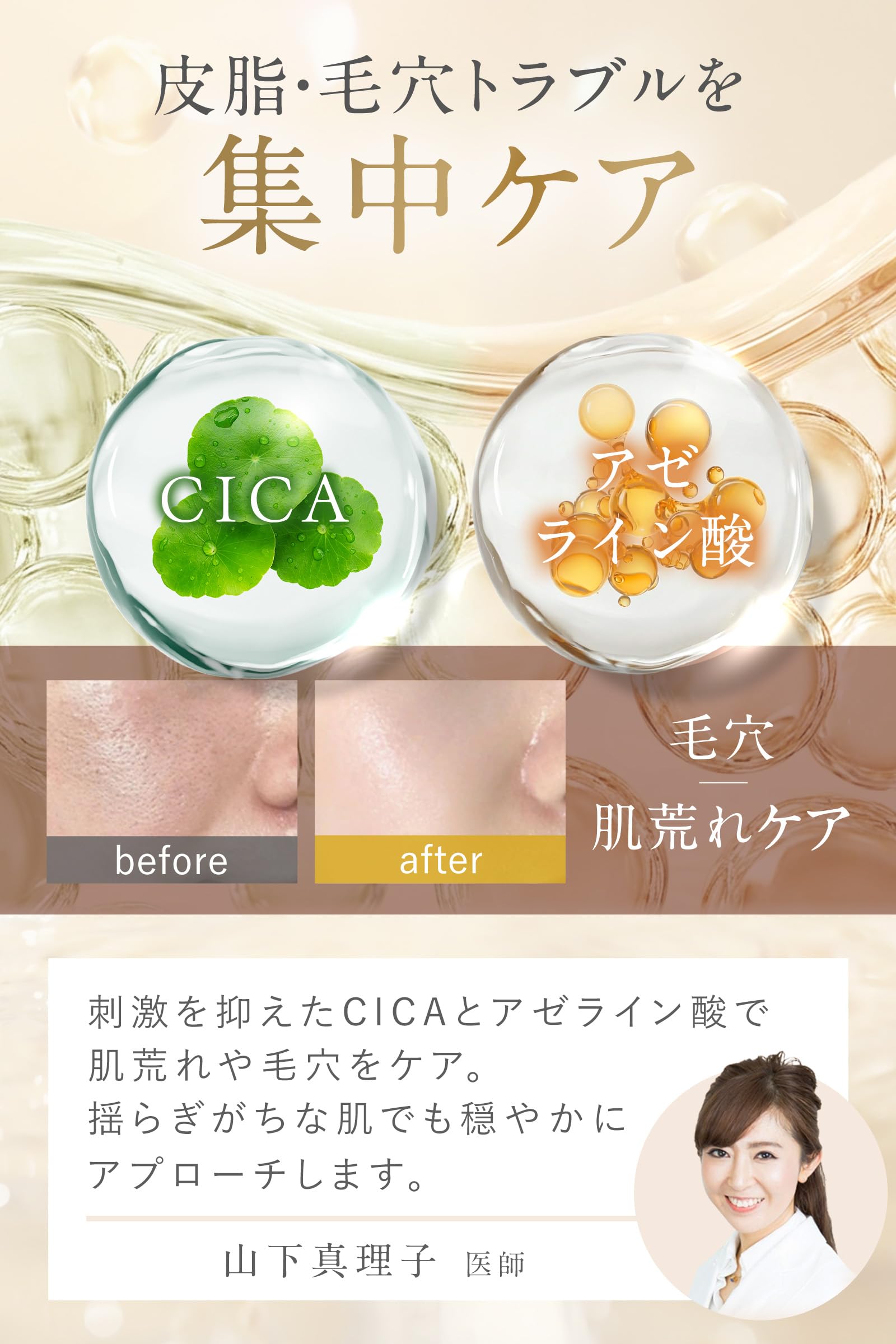 Amazon.co.jp: idio イディオ アゼライン酸 CICA シートマスク 大容量