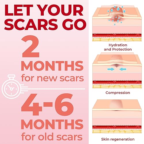 Miniatura 6 de Hojas de silicona de grado médico para cicatrices  Paquete de 6 unidades (7 x 1.6 pulgadas)  Diferencia visible en cicatrices de cesárea  Hojas de