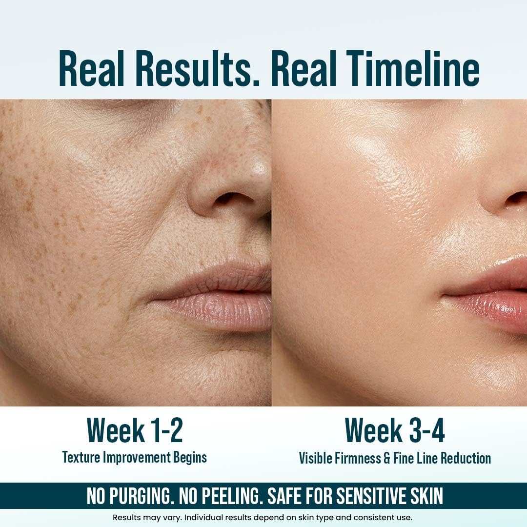 ghk cu real results Amazon.com: Bargad 5% GHK-Cu Copper Peptide Face Serum – Anti-Aging Firming  Serum for Fine Lines & Skin Renewal – With 2% Niacinamide, Hyaluronic Acid,  Alpha Arbutin & Centella Asiatica – All Skin