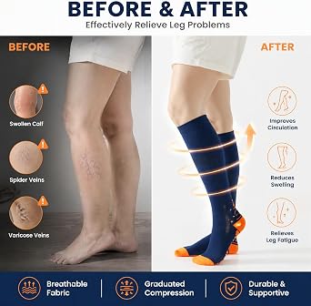 BISOUSOX Compression Socks for Men and Women 15-20 mmHg Knee High Sports Support Socks for Running & Tranning & Cycling 2 Pairs Compression Stockings for Flying,Pregnancy,Hospital