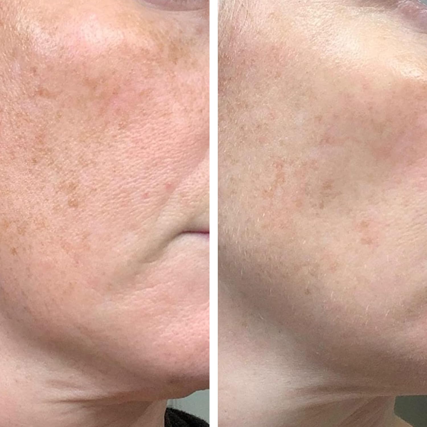 Gel Viso Anti-Età Notte: Riduce Macchie Scure e Pori Dilatati – Uniforma il Tono e Minimizza Imperfezioni – Adatto a Tutti i Tipi di Pelle – Formula Naturale con Vitamina C, E e Acido Ialuronico