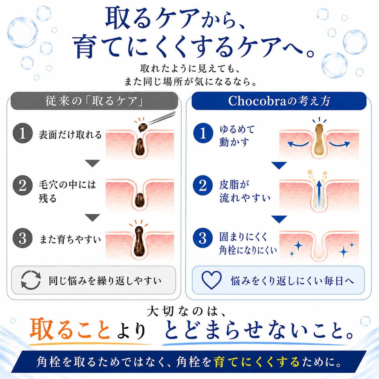 Amazon | Chocobra チョコブラ スペシャル毛穴ケアセット 黒ずみ 角栓