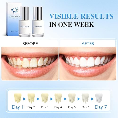 Miniatura 3 de Smile Actives Pro - Gel blanqueador – Pintura de dientes instantánea para uso diario, kit de esmalte líquido seguro y suave que promueve el aliento