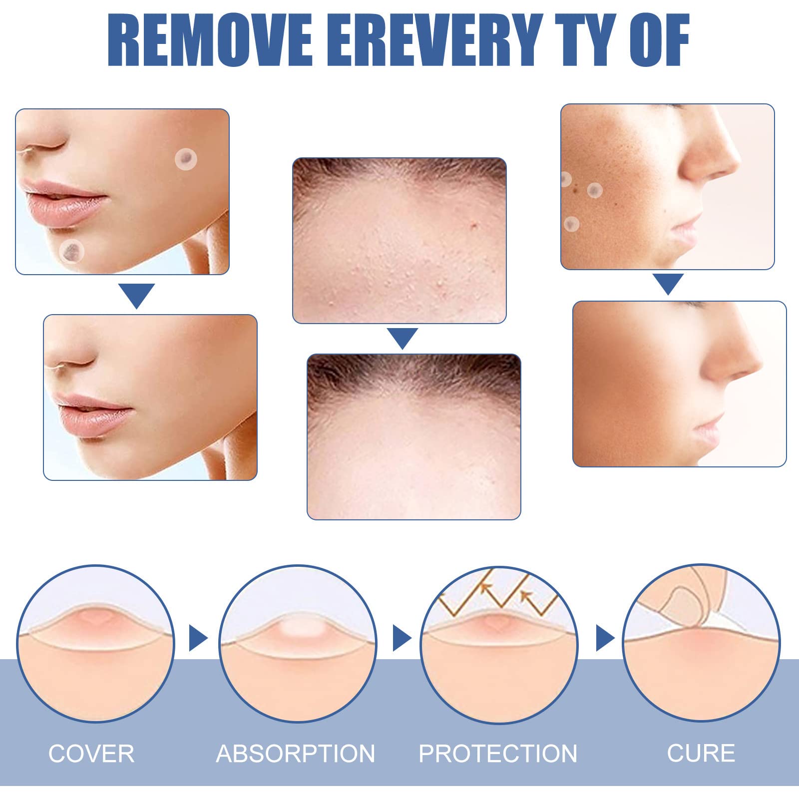 Wart and Mole Removal Patches,Parches Quita Verrugas Cuello y Cara,Producto de Verrugas,Skin Tag Removal Patches,Parches Quita Wart Cuello y Cara,para Mujer Hombre,144 Piezas