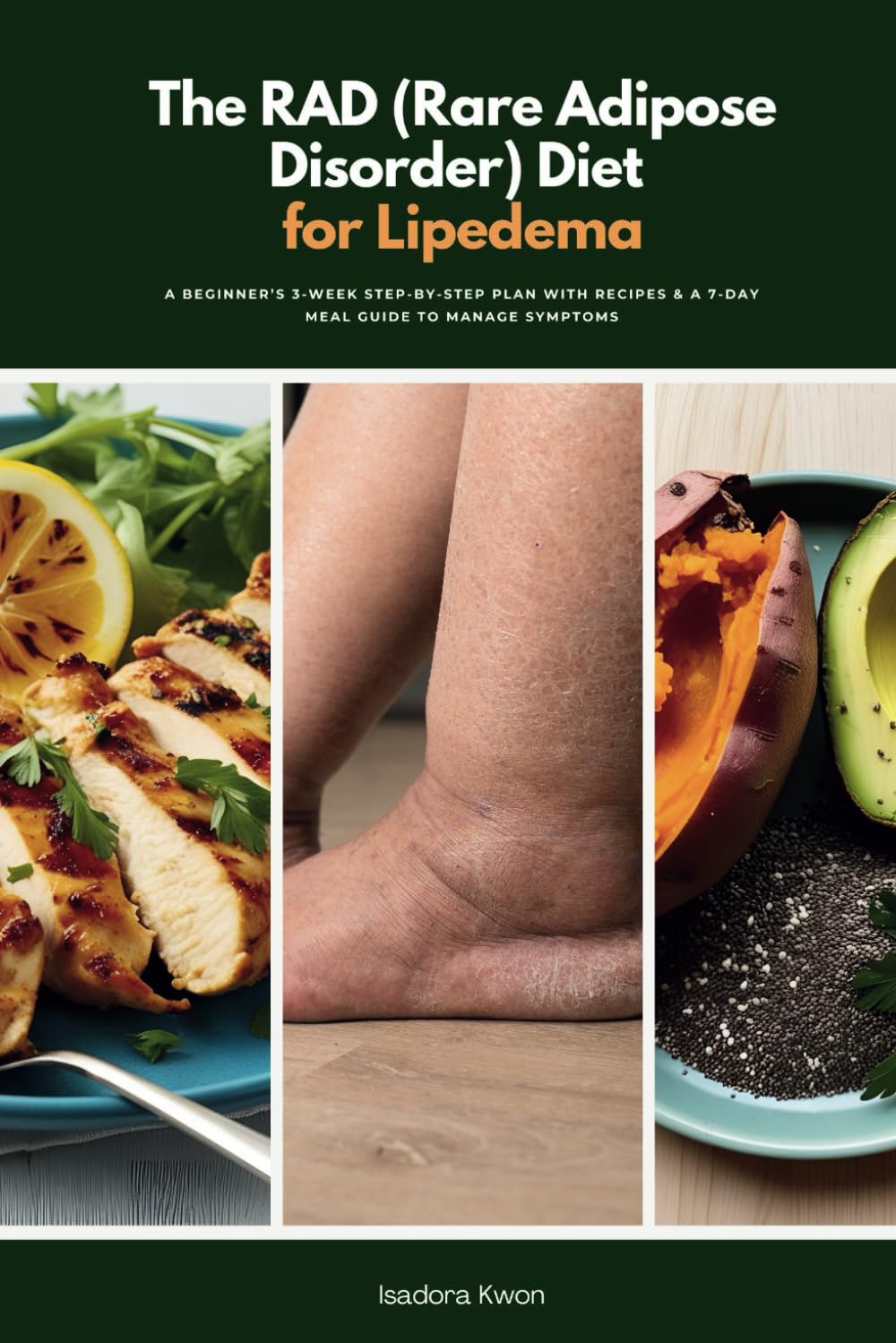 The RAD (Rare Adipose Disorder) Diet for Lipedema: A Beginner’s 3-Week Step-by-Step Plan with Recipes & a 7-Day Meal Guide to Manage Symptoms
