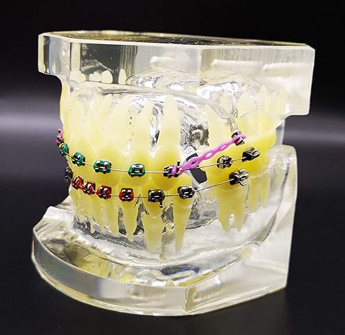 Miniatura 4 de Typodont dental con soportes metálicos Modelo de dientes de ortodoncia con ligadura