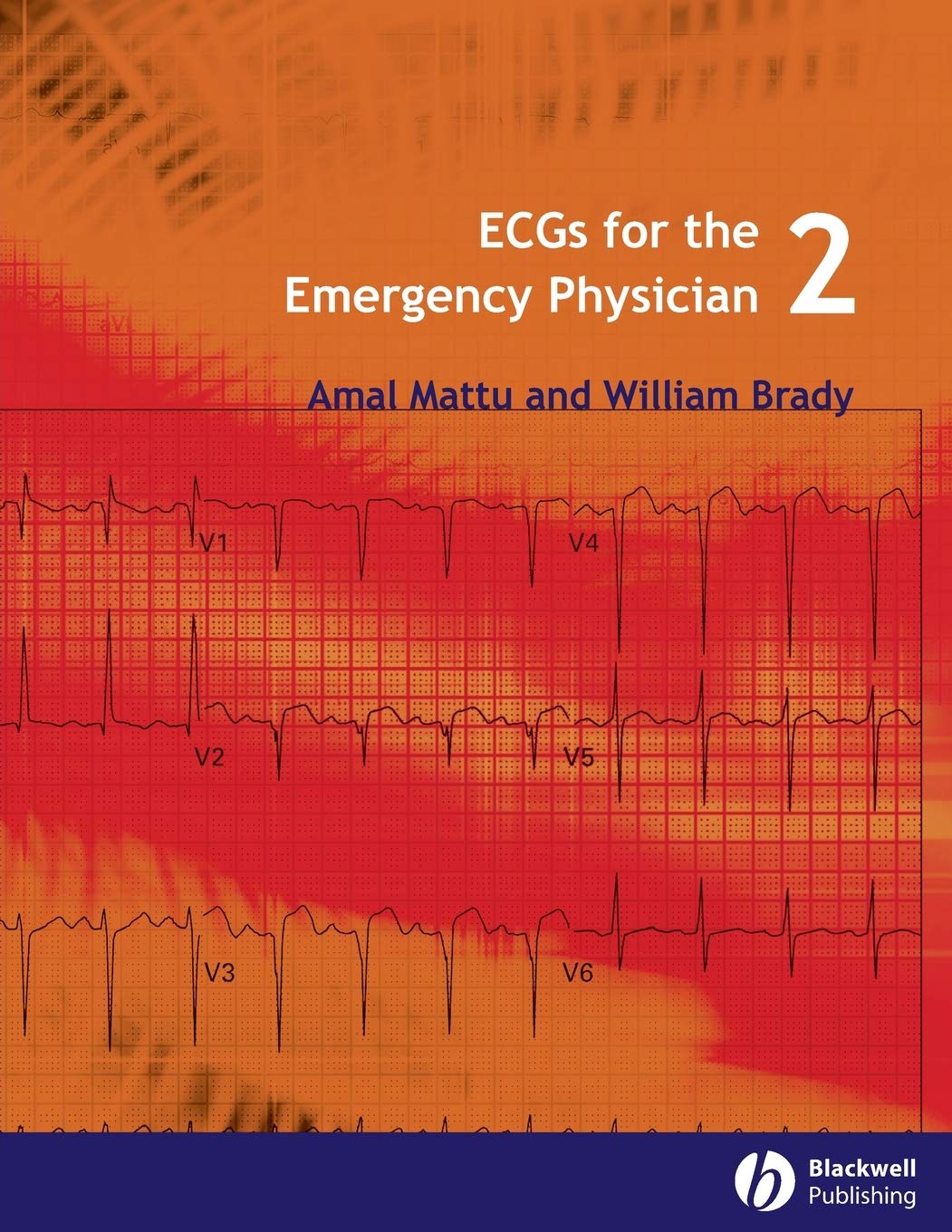 ECGs for the Emergency Physician 2 by Amal Mattu, William J. ... - 9781405157018